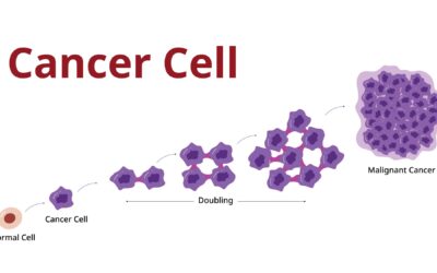 Stages of Cancer, Explained