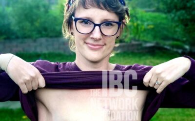 #ScarsOfStrength – Kristin’s Story