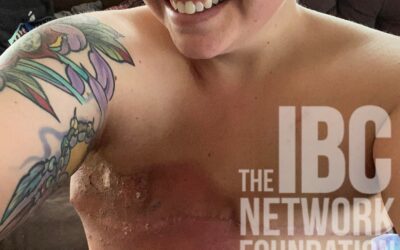 #ScarsOfStrength – Savannah’s Story