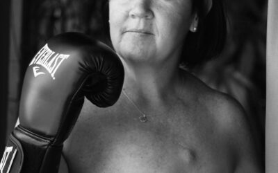 #ScarsOfStrength – Tracey’s Story